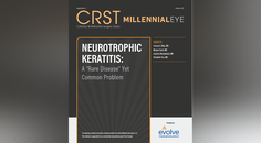 Neurotrophic Keratitis A Rare Disease Yet Common Problem