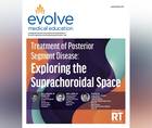 Treatment of Posterior Segment Disease Exploring the Suprachoroidal Space