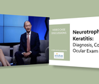 Neurotrophic Keratitis Diagnosis Comorbidities Ocular Exam