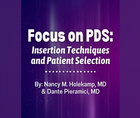 Focus on PDS Insertion Techniques and Patient Selection