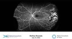 Retina Rounds July