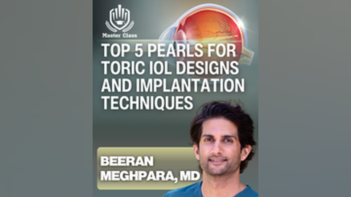 Master Class Top 5 Pearls for Toric IOL Designs and Implantation Techniques