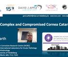 Chapter 5 Treating Complex Cornea Cataract Patients