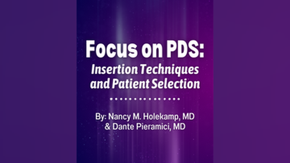 Focus on PDS Insertion Techniques and Patient Selection