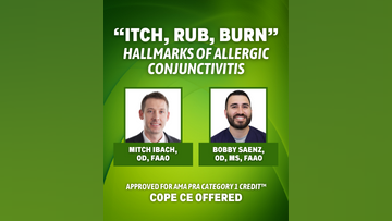 Itch Rub Burn Hallmarks of Allergic Conjunctivitis