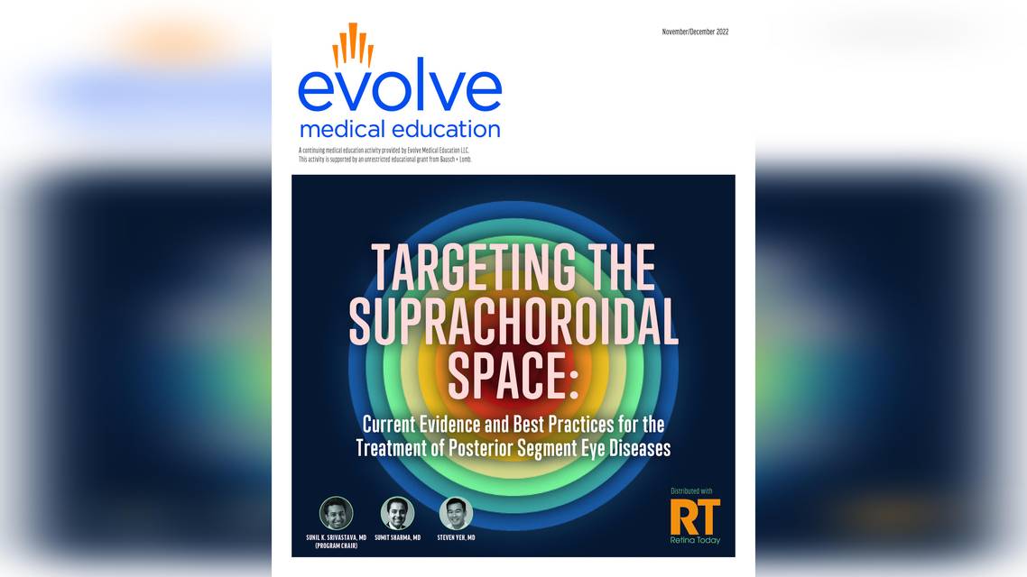Targeting the Suprachoroidal Space Current Evidence and Best Practices for the Treatment of Posterior Segment Eye Diseases
