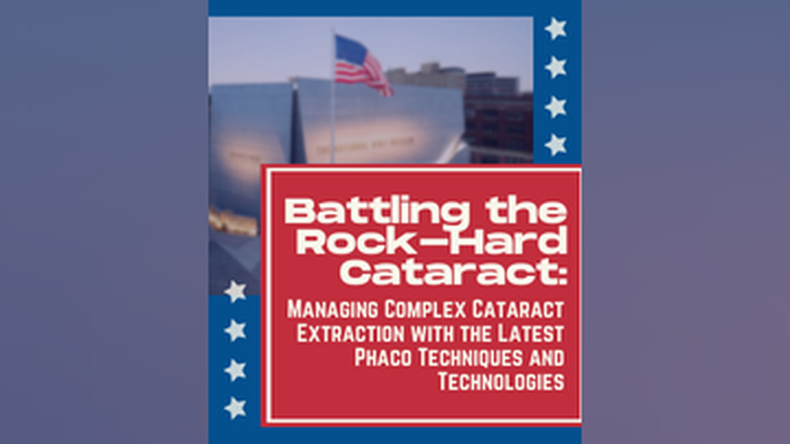 Battling the RockHard Cataract Managing Complex Cataract Extraction with the Latest Phaco Techniques and Technologies