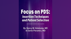 Focus on PDS Insertion Techniques and Patient Selection