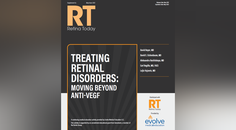Treating Retinal Disorders Moving Beyond AntiVEGF