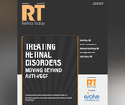 Treating Retinal Disorders Moving Beyond AntiVEGF