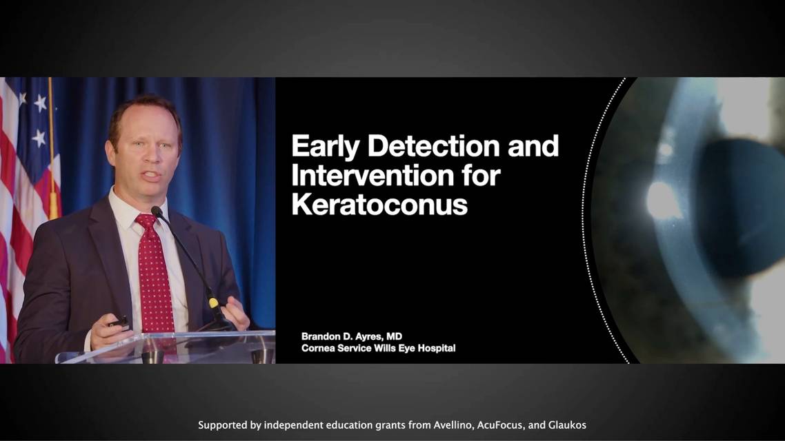 Chapter 3 Early Detection and Intervention for Keratoconus