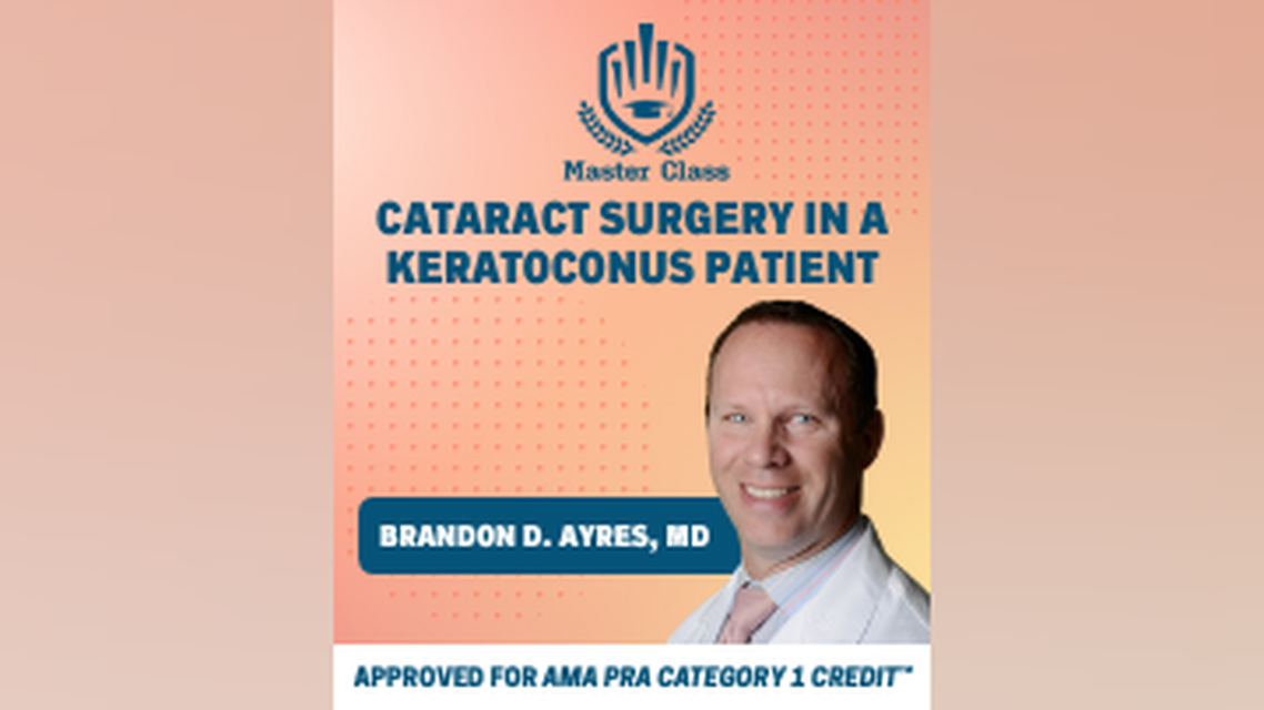 Cataract Surgery in a Keratoconus Patient