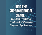 Into the Suprachoroidal Space The Next Frontier in Treatment of Posterior Segment Eye Disease