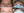 Fig11_32750