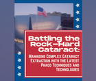 Battling the RockHard Cataract Managing Complex Cataract Extraction with the Latest Phaco Techniques and Technologies