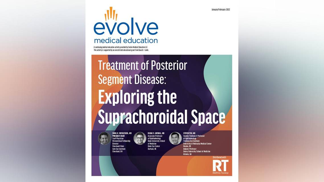 Treatment of Posterior Segment Disease Exploring the Suprachoroidal Space