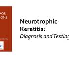 Neurotrophic Keratitis Diagnosis and Testing