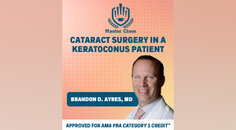 Cataract Surgery in a Keratoconus Patient