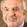 Murray Fingeret, OD, FAAO