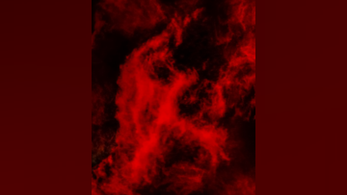 VBS Fellows Foray 2024 Retinas Believe it or Not CaseBased Examples and RealWorld Treatment Strategies