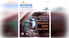 Earlier Identification and Treatment of Keratoconus Progression Managing the Complex Cornea Patient
