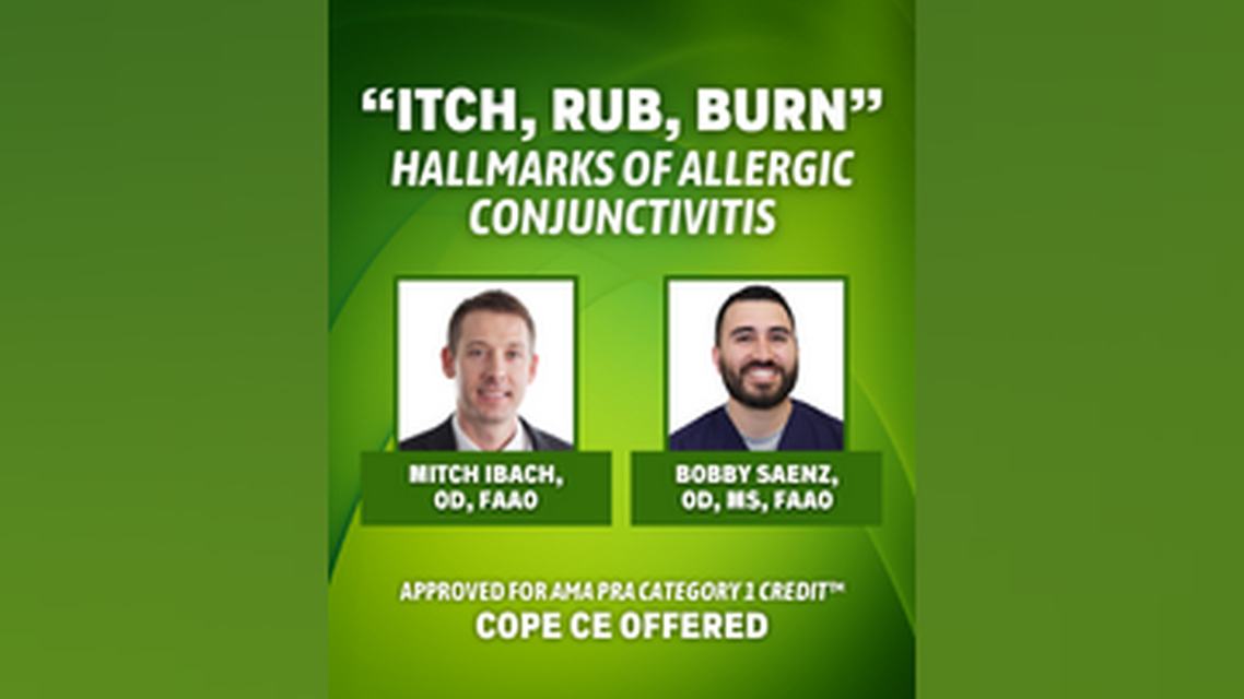 Itch Rub Burn Hallmarks of Allergic Conjunctivitis