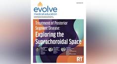 Treatment of Posterior Segment Disease Exploring the Suprachoroidal Space