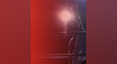 KOL Knockout Cataract Edition More than Best Corrected Visual Acuity Meeting Patient Refractive Expectations Round 1