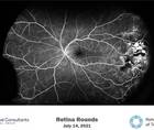 Retina Rounds July