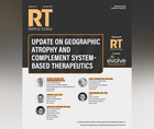 Update on Geographic Atrophy and Complement Systembased Therapeutics