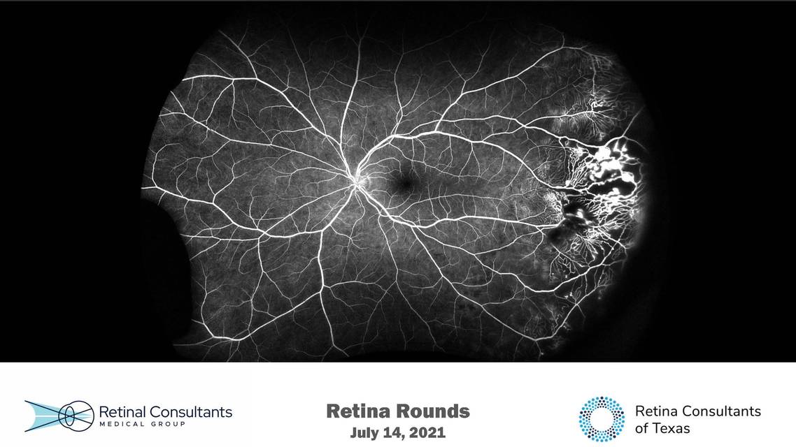 Retina Rounds  July