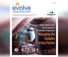 Earlier Identification and Treatment of Keratoconus Progression Managing the Complex Cornea Patient